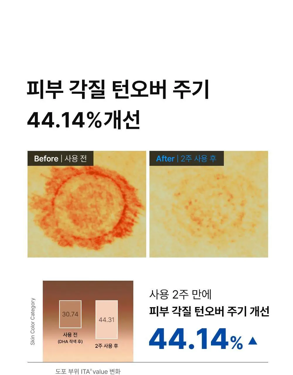 [턴오버주기개선] 동아제약 색소침착 프로 액제 30ml 상세페이지 9